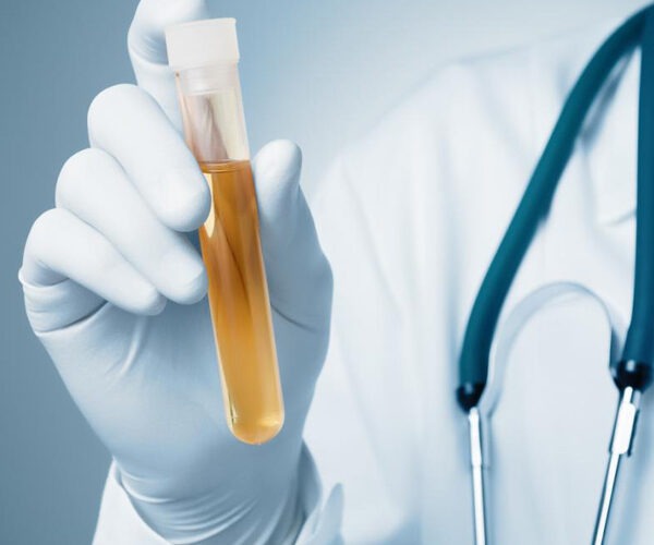 urine-analysis-sadr