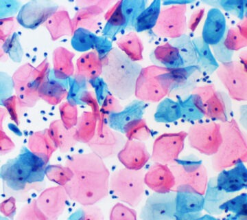 Cytogy