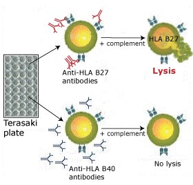 hla1