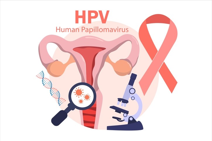 آزمایش HPV بانوان زگیل تناسلی