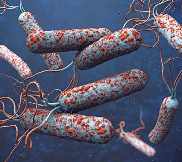 باکتری وبا بوردتلا