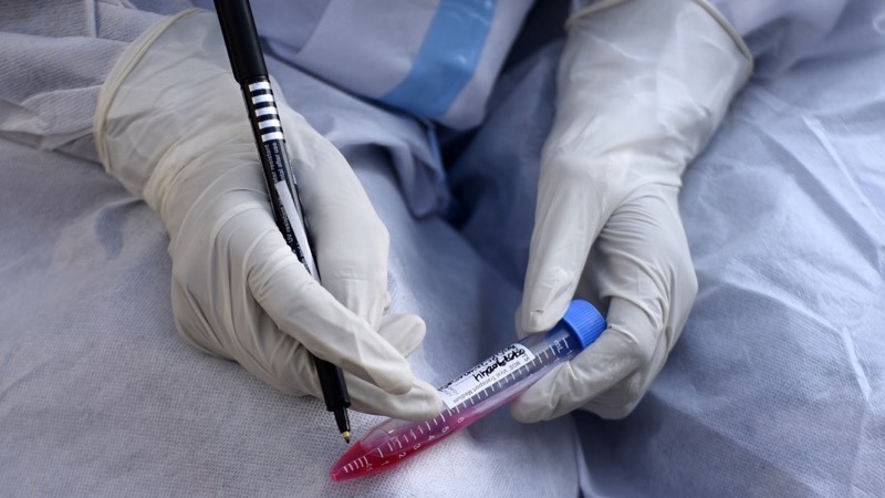 ویروس کرونا پیرولا