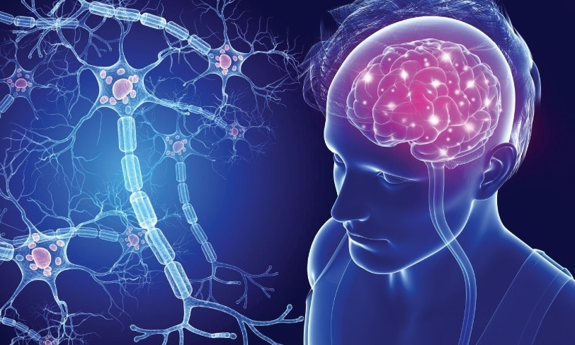 یبماری ام اس