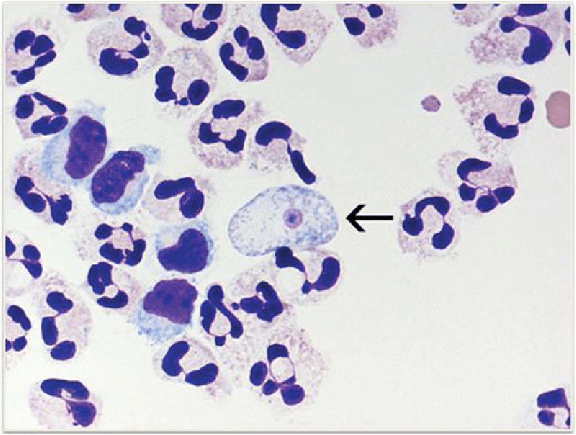 Naegleria-fowleri-trophozoite