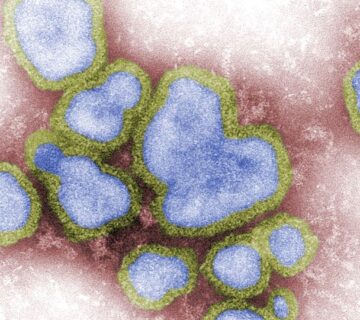 ویروس آنفولانزا