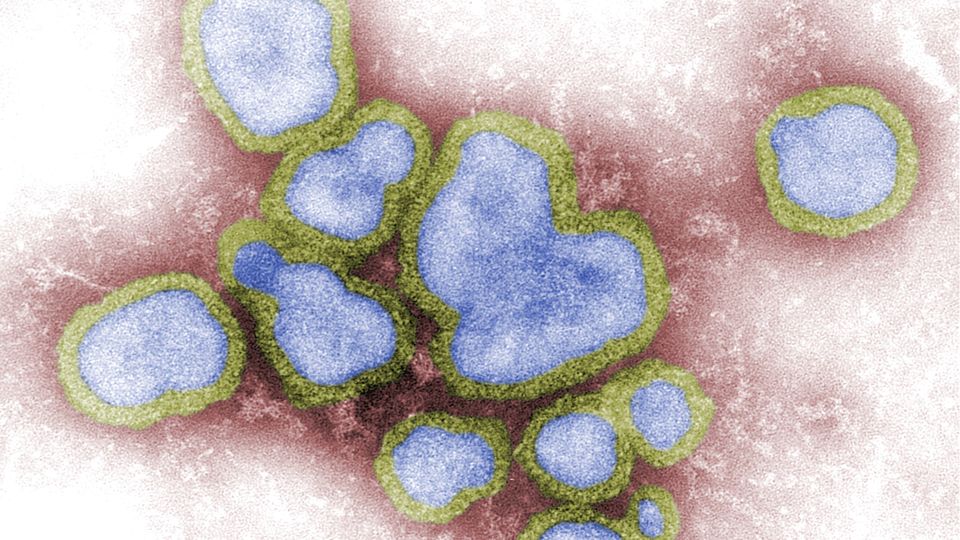 ویروس آنفولانزا