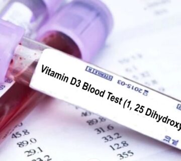 آزمایش ویتامین D3