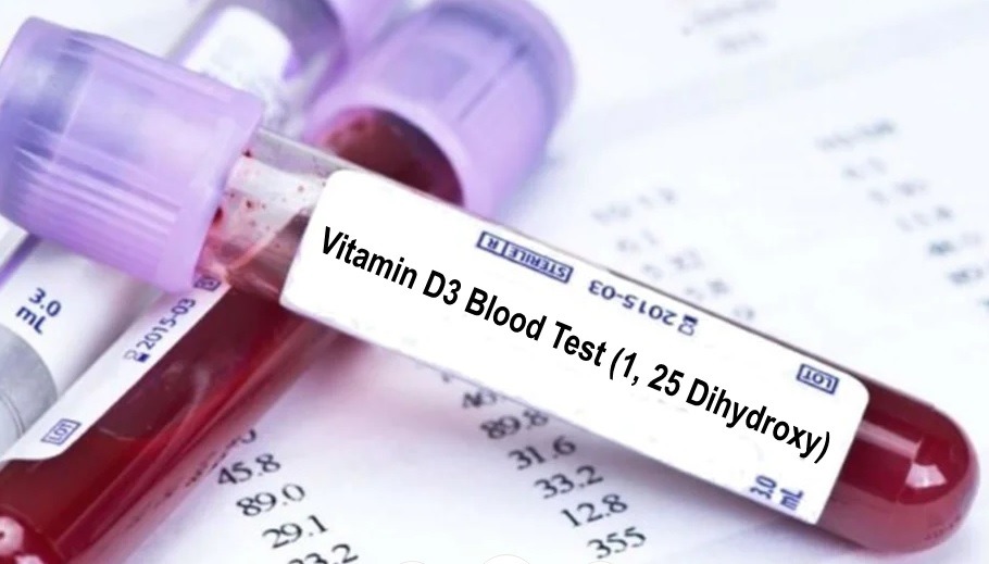 آزمایش ویتامین D3
