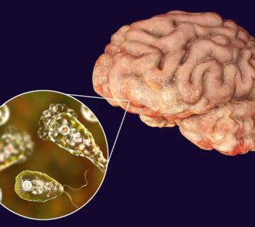 آمیب مغزخوار