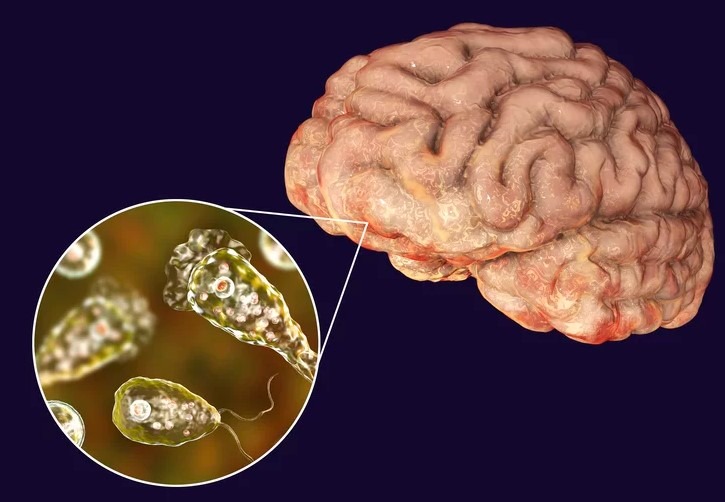 آمیب مغزخوار
