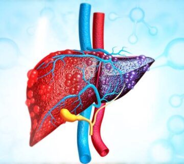 بیماری هپاتیت