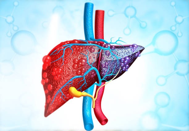 بیماری هپاتیت