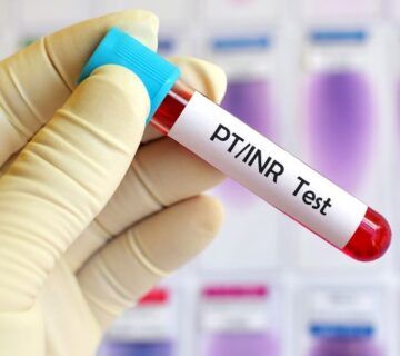 PT-inr-test