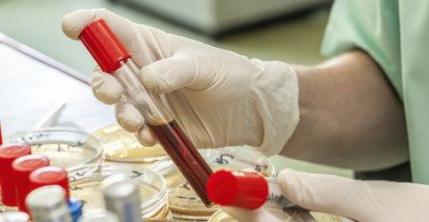 آزمایش آبله مرغان