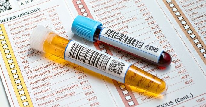 آزمایش آلبومین