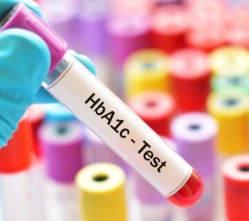 آزمایش-hba1c