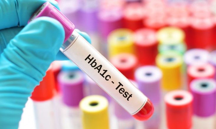 آزمایش-hba1c