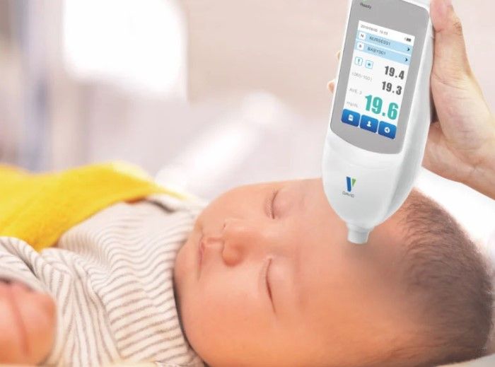 آزمایش بیلی روبین