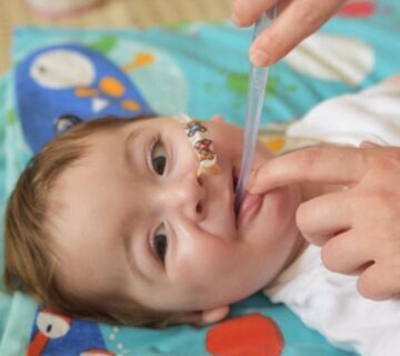 عکس بیماری SMA