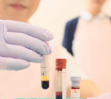 عکس هموفیلی