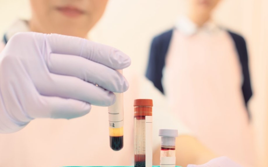 عکس هموفیلی