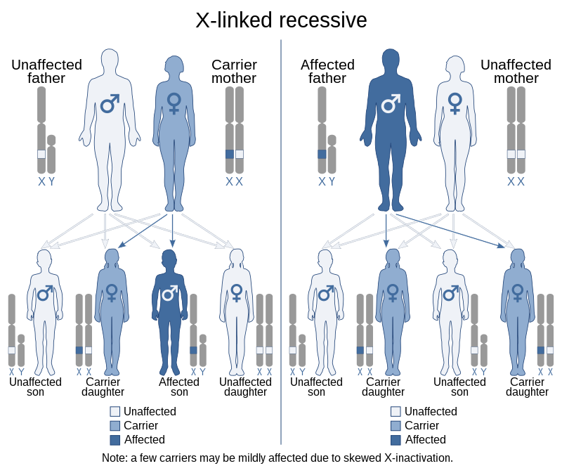 هموفیای کروموزم X