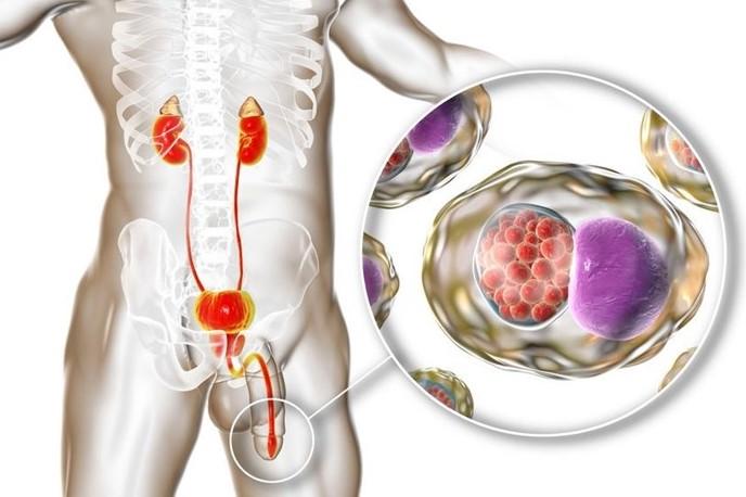 ویروس کلامدیا