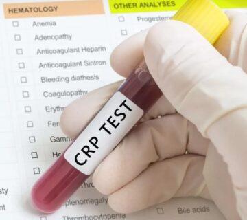 crp-test