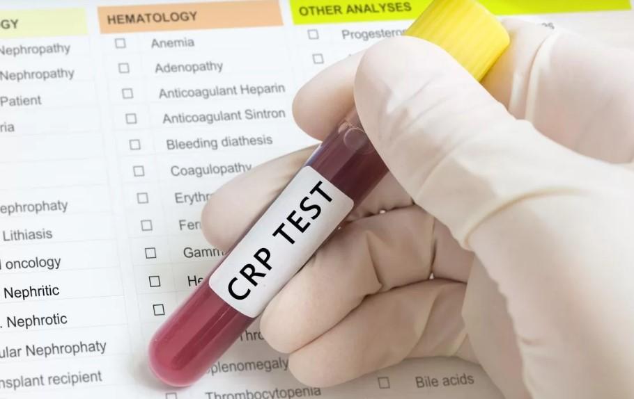 crp-test