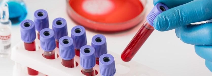 mix بالا در آزمایش خون