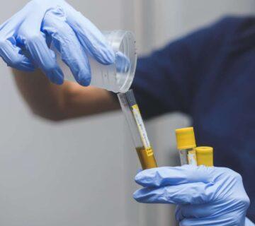 تاثیر دارو بر نتیجه آزمایش