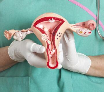 cervical-cancer 16 -18