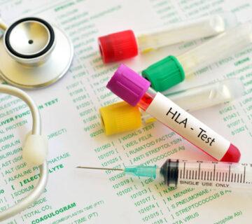 hla-b5-test