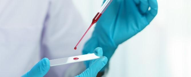 بالابودن RBCدر خون