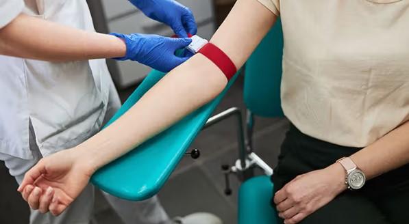 عکس آزمایش MCHC