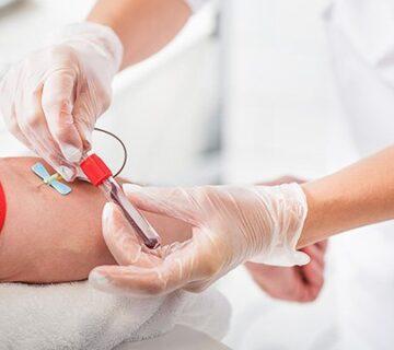 آزمایش D-dimer