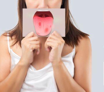 بیماری بهجت