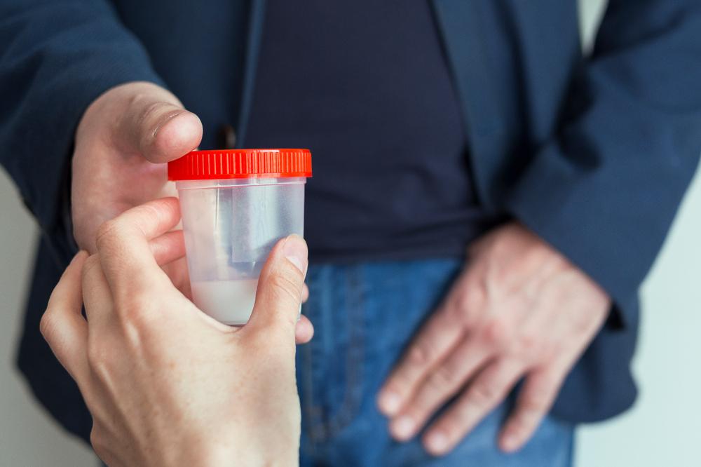 دستوالعمل آزمایش منی