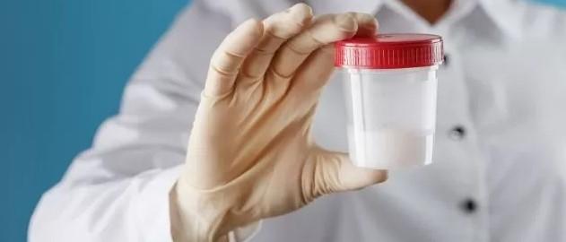 عکس نمونه ظرف برای مایع منی