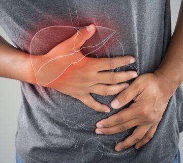 هموکروماتوز