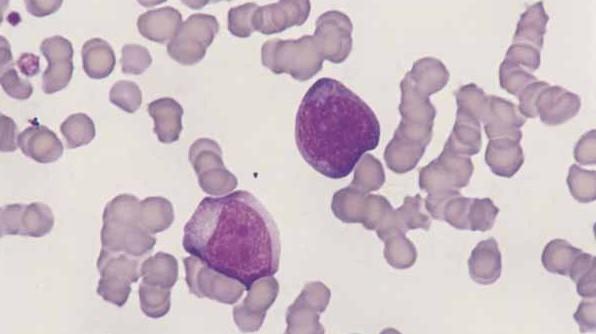 lymphocytes