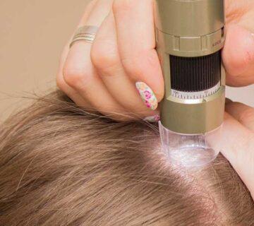 آزمایش ریزش مو