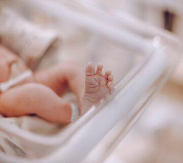 عکس سندروم نوزاد خاکستری