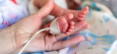 عکس غربالگری نوزاد از کف پا