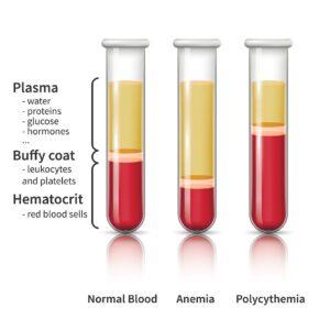 Hematocrit-آزمایش