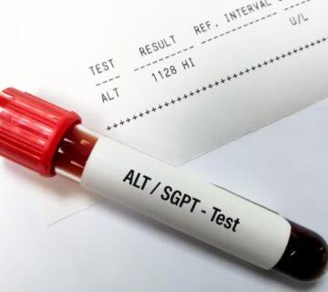 آزمایش ALT-SGPT