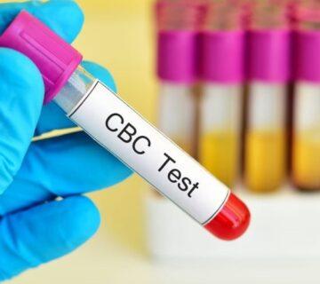 آزمایش CBC خون