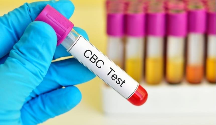 آزمایش CBC خون