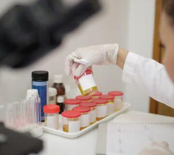 سلول‌های پوششی در ادرار