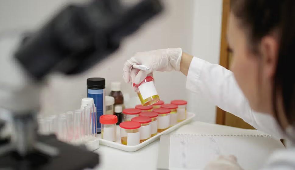 سلول‌های پوششی در ادرار